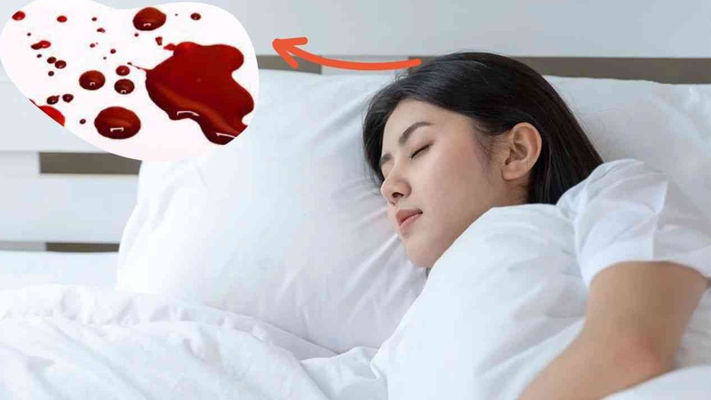 Nằm mơ thấy chảy máu ở đầu