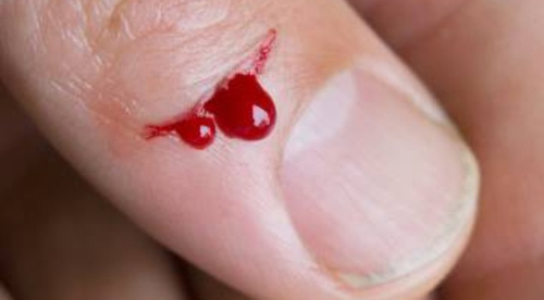 Nằm mơ thấy người khác chảy máu