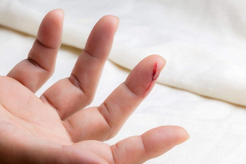Ngủ mơ thấy đánh nhau chảy máu