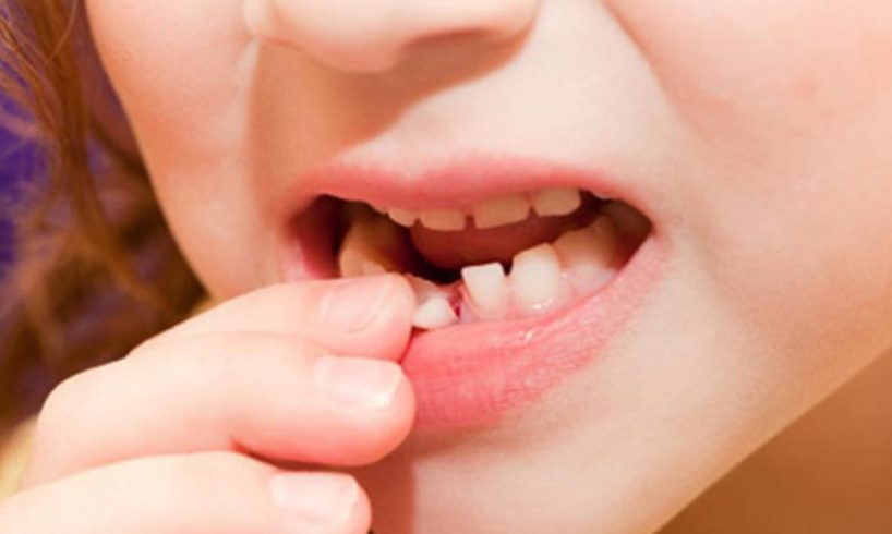 Nằm mơ thấy rụng răng hàm dưới